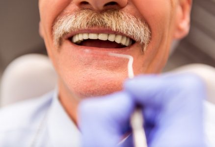 Все, что нужно знать об имплантации зубов
