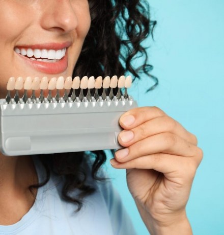 Ламинирование зубов