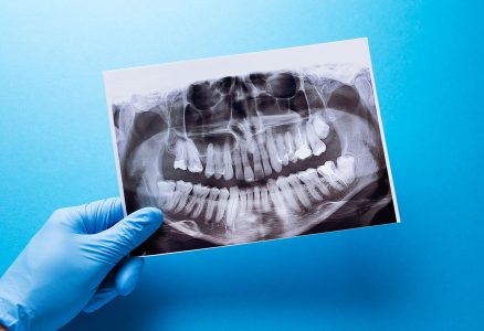 Пародонтит – болезнь нечищеных зубов