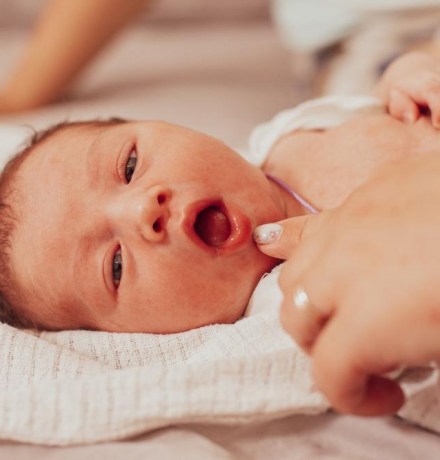 Пластика уздечки языка: зачем и как подрезают уздечку?