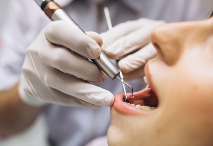 Рекомендации после удаления зубов