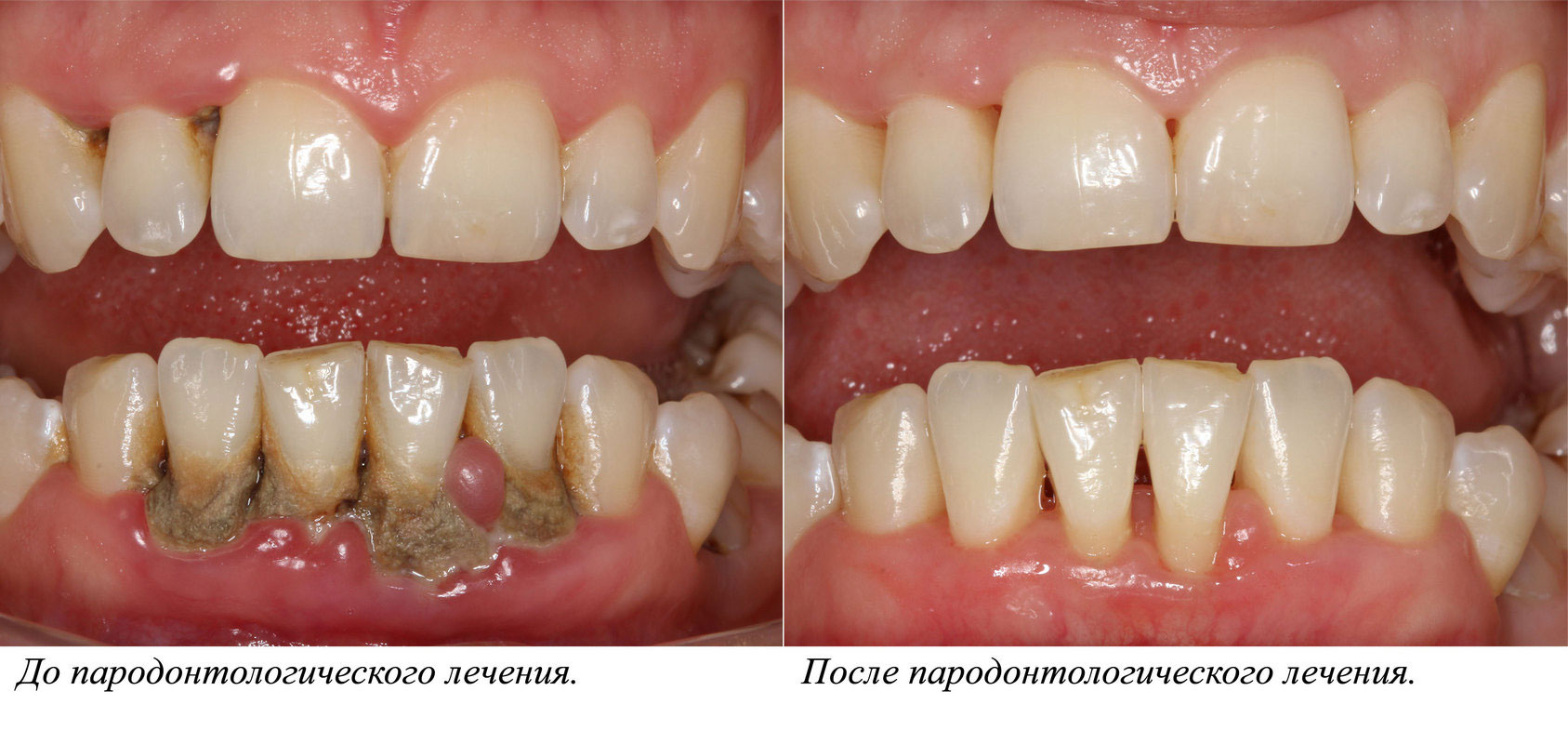 Работы Стоматологов Фото До И После
