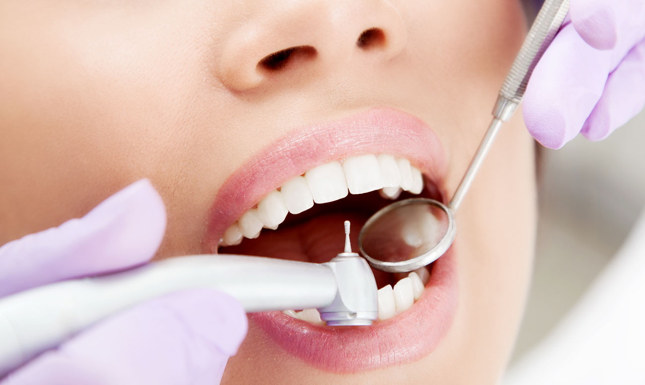 Кариес: причины появления, лечение, профилактика – стоматология Президент