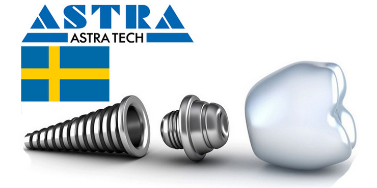 Имплант премиум сегмента Astra Tech + коронка из диоксида циркония