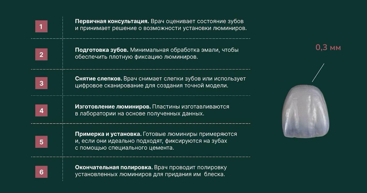этапы установки люминиров