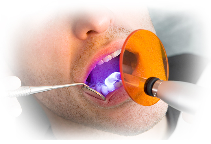 Лазерное десен. Лазерная терапия в стоматологии. Физиолечение лазером зуба. Гель неоновый лазер в стоматологии.