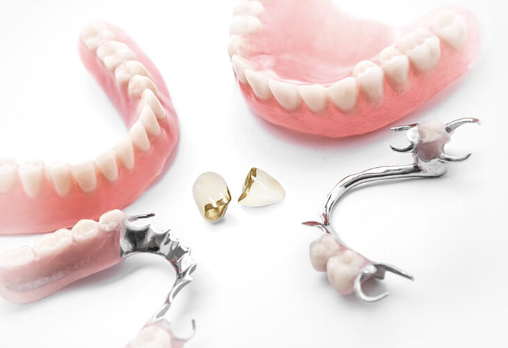 Балочный протез на имплантах. Стоматология имплантация. Керамическая зубная коронка. Проспект комсомольский 81 протезирование зубов. Шинирование в стоматологии.