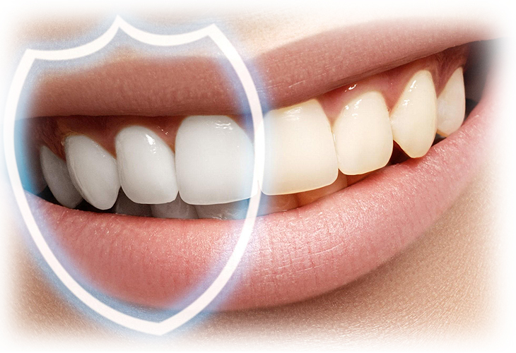 Можно ли восстановить зубную эмаль и как это сделать – стоматология  Президент
